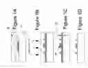 Fig. 02 - Method and system for tone inverting of residual layer tolerant imprint lithography