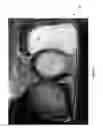 Fig. 02 - Microwave cooking containers with shielding