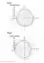Fig. 06 - Array antenna apparatus including multiple steerable antennas and capable of avoiding affection among steerable antennas
