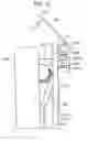 Fig. 13 - Panel support device and X-ray apparatus