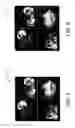 Fig. 07 - MODEL-BASED SPECT HEART ORIENTATION ESTIMATION