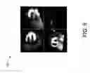 Fig. 08 - MODEL-BASED SPECT HEART ORIENTATION ESTIMATION