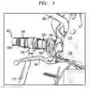 Fig. 02 - Tie down device for securing vehicles with handlebars for transport