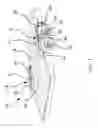 Fig. 02 - Drive-over collapsible fender