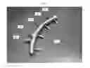 Fig. 06 - Device for intranasal administration