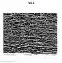 Fig. 06 - Multilayer fibrous polymer scaffolds, methods of production and methods of use