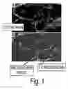Fig. 02 - Vocal Cord Augmentation Utilizing Muscle-Derived Progenitor Compositions, and Treatments Thereof