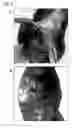 Fig. 09 - COLLAGEN-CONTAINING CELL CARRIER