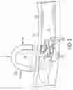 Fig. 04 - Method and apparatus for thrombus removal using magnetic particles