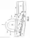 Fig. 07 - Method and apparatus for thrombus removal using magnetic particles