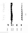 Fig. 04 - COMPOSITIONS AND METHODS FOR TREATING COLLAGEN-MEDIATED DISEASES