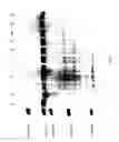 Fig. 05 - COMPOSITIONS AND METHODS FOR TREATING COLLAGEN-MEDIATED DISEASES