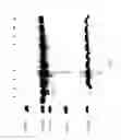 Fig. 10 - COMPOSITIONS AND METHODS FOR TREATING COLLAGEN-MEDIATED DISEASES