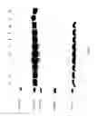 Fig. 11 - COMPOSITIONS AND METHODS FOR TREATING COLLAGEN-MEDIATED DISEASES