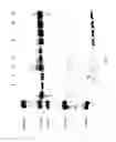 Fig. 12 - COMPOSITIONS AND METHODS FOR TREATING COLLAGEN-MEDIATED DISEASES