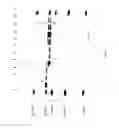 Fig. 13 - COMPOSITIONS AND METHODS FOR TREATING COLLAGEN-MEDIATED DISEASES