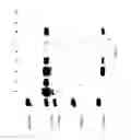 Fig. 15 - COMPOSITIONS AND METHODS FOR TREATING COLLAGEN-MEDIATED DISEASES