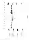Fig. 18 - COMPOSITIONS AND METHODS FOR TREATING COLLAGEN-MEDIATED DISEASES
