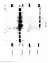Fig. 19 - COMPOSITIONS AND METHODS FOR TREATING COLLAGEN-MEDIATED DISEASES