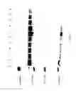 Fig. 22 - COMPOSITIONS AND METHODS FOR TREATING COLLAGEN-MEDIATED DISEASES