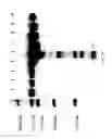 Fig. 29 - COMPOSITIONS AND METHODS FOR TREATING COLLAGEN-MEDIATED DISEASES