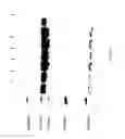 Fig. 35 - COMPOSITIONS AND METHODS FOR TREATING COLLAGEN-MEDIATED DISEASES