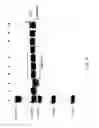 Fig. 43 - COMPOSITIONS AND METHODS FOR TREATING COLLAGEN-MEDIATED DISEASES