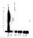 Fig. 46 - COMPOSITIONS AND METHODS FOR TREATING COLLAGEN-MEDIATED DISEASES