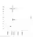 Fig. 57 - COMPOSITIONS AND METHODS FOR TREATING COLLAGEN-MEDIATED DISEASES