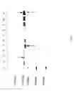 Fig. 58 - COMPOSITIONS AND METHODS FOR TREATING COLLAGEN-MEDIATED DISEASES