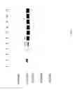 Fig. 60 - COMPOSITIONS AND METHODS FOR TREATING COLLAGEN-MEDIATED DISEASES