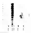 Fig. 66 - COMPOSITIONS AND METHODS FOR TREATING COLLAGEN-MEDIATED DISEASES