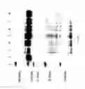 Fig. 70 - COMPOSITIONS AND METHODS FOR TREATING COLLAGEN-MEDIATED DISEASES
