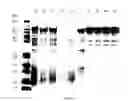 Fig. 76 - COMPOSITIONS AND METHODS FOR TREATING COLLAGEN-MEDIATED DISEASES