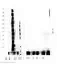 Fig. 80 - COMPOSITIONS AND METHODS FOR TREATING COLLAGEN-MEDIATED DISEASES