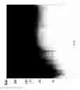 Fig. 85 - COMPOSITIONS AND METHODS FOR TREATING COLLAGEN-MEDIATED DISEASES