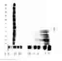 Fig. 90 - COMPOSITIONS AND METHODS FOR TREATING COLLAGEN-MEDIATED DISEASES