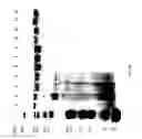 Fig. 91 - COMPOSITIONS AND METHODS FOR TREATING COLLAGEN-MEDIATED DISEASES