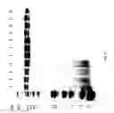 Fig. 92 - COMPOSITIONS AND METHODS FOR TREATING COLLAGEN-MEDIATED DISEASES