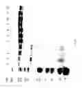 Fig. 93 - COMPOSITIONS AND METHODS FOR TREATING COLLAGEN-MEDIATED DISEASES