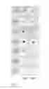 Fig. 02 - Method for predicting the risk of disease based on lectin binding