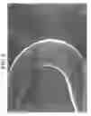 Fig. 09 - IN-VIVO INDWELLING DEVICE