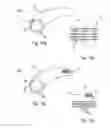 Fig. 08 - Method and device for electrochemical formation of therapeutic species in vivo