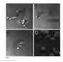 Fig. 08 - Templated islet cells and small islet cell clusters for diabetes treatment