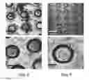 Fig. 16 - Templated islet cells and small islet cell clusters for diabetes treatment