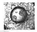 Fig. 20 - Templated islet cells and small islet cell clusters for diabetes treatment