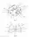 Fig. 02 - Orthodontic bracket having an archwire channel and archwire retaining mechanism