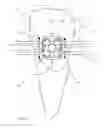 Fig. 06 - Orthodontic bracket having an archwire channel and archwire retaining mechanism
