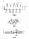 Fig. 09 - ADDRESSABLE MATRICES/CLUSTER BLANKS FOR DENTAL CAD/CAM SYSTEMS AND OPTIMIZATION THEREOF