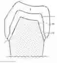 Fig. 01 -  METHOD OF DESIGNING A TOOTH REPLACEMENT PART, A METHOD OF PROCESSING A DESIGNED TOOTH REPLACEMENT PART, A TOOTH REPLACEMENT PART, AND A COMPUTER-READABLE MEDIUM